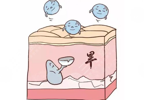 热玛吉一次多少钱?