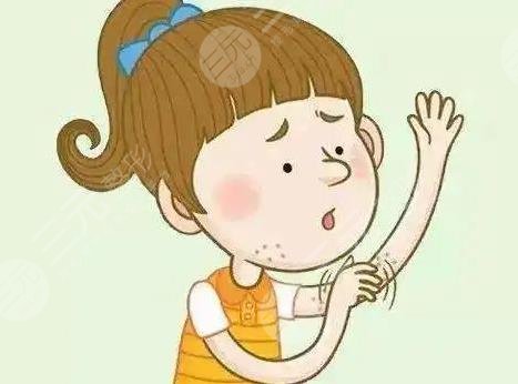 如何治疗湿疹样皮炎