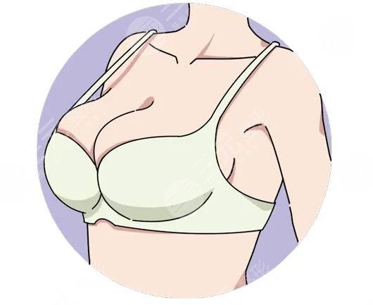 傲若拉假体术后注意事项