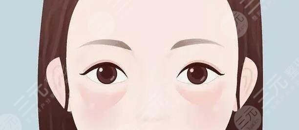 眼袋手术1-10天图片反馈，有眼袋or无眼袋区别不是一般大！至少年轻几岁~