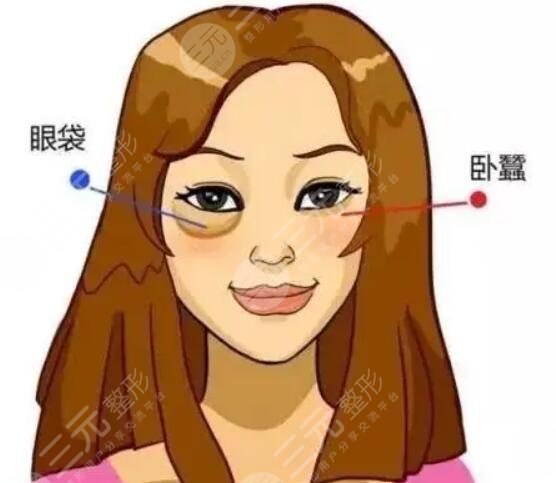 眼袋手术1--10天图片反馈