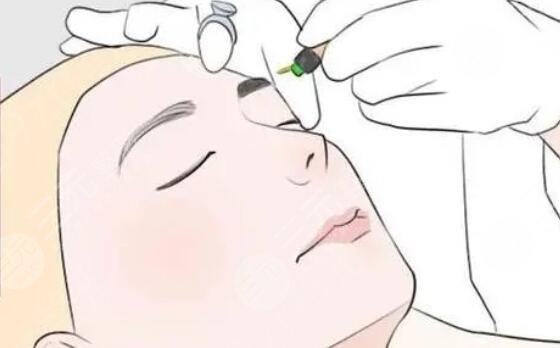 纹眉