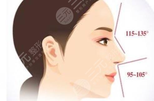 歪鼻矫正