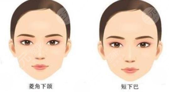 磨骨