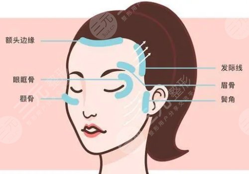 上海薇琳医疗美容医院面部轮廓怎么样