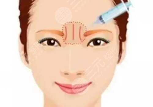 西安画美医疗美容医院注射玻尿酸价格