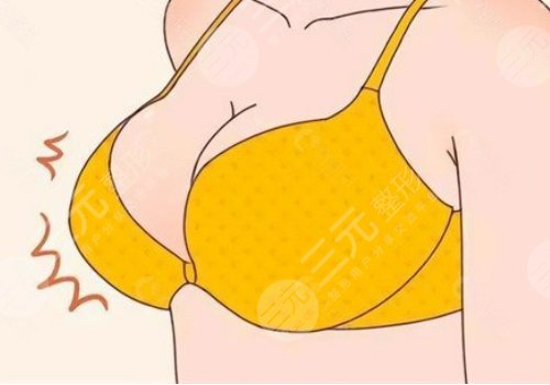 杭州格莱美医疗美容医院隆胸怎么样？