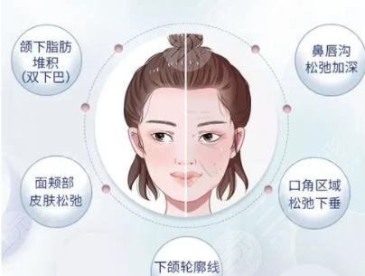 热拉提