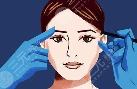 双眼皮