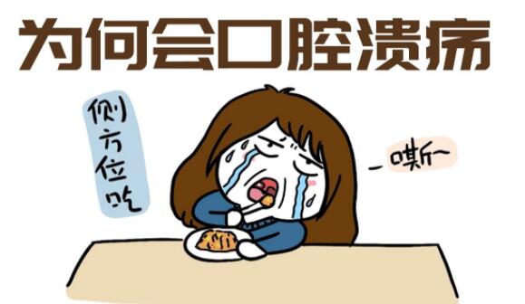 口腔溃疡的介绍