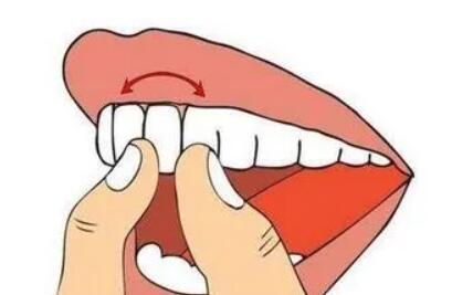 牙齿松动