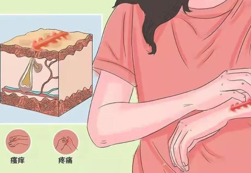祛疤手臂
