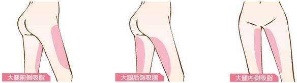 深圳阳光医美热门项目