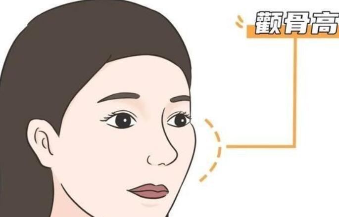 颧骨