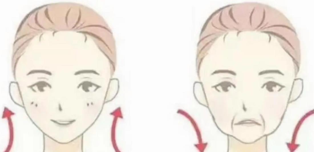 面部提升