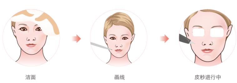皮秒
