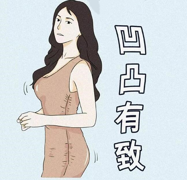 自体脂肪隆胸