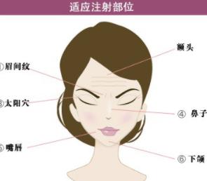 除皱