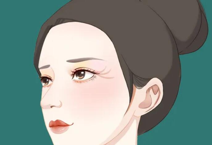 拉皮