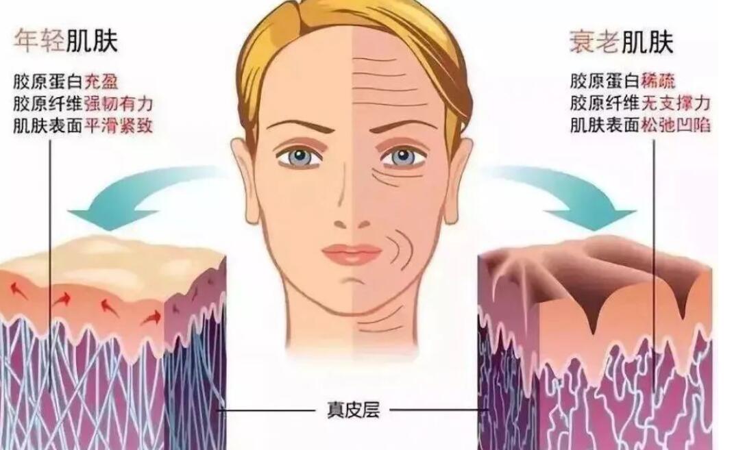抗衰