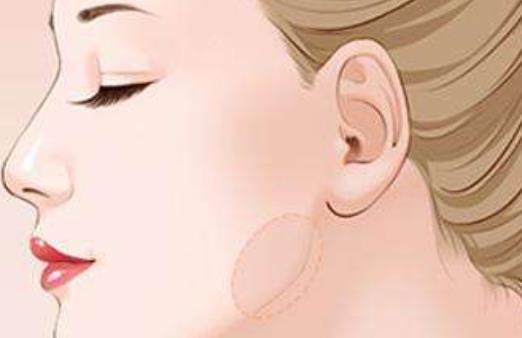 下颌角