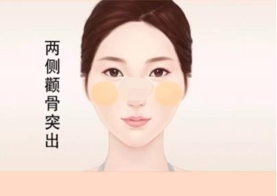 颧骨