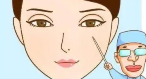 双眼皮