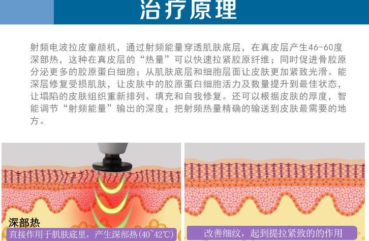 拉皮