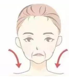 注射除皱
