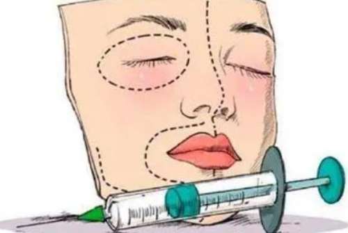 玻尿酸注射动漫02.jpg