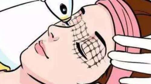 热玛吉.jpg
