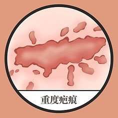 不.jpg