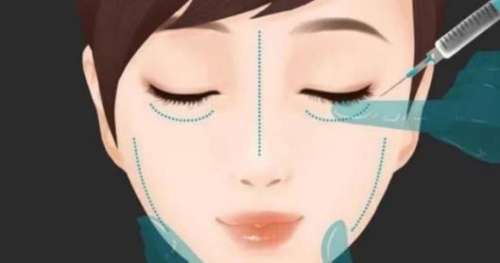 玻尿酸21.jpg