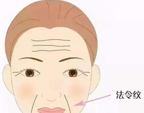 法令纹02.jpg