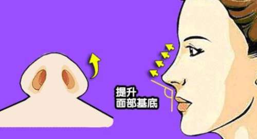 注射鼻基底动漫03.jpg