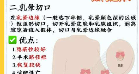 隆胸2.jpg