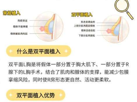 隆胸6.jpg