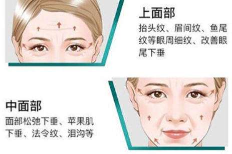 热玛吉