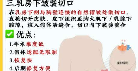 隆胸3.jpg