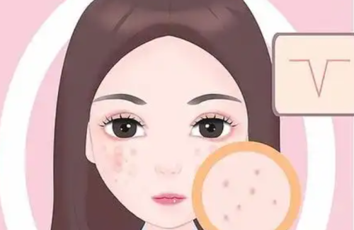 QQ截图20260409171025.png