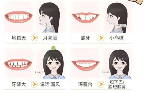 牙齿矫正