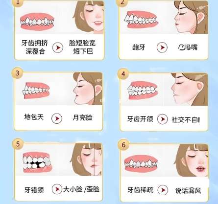 牙齿矫正