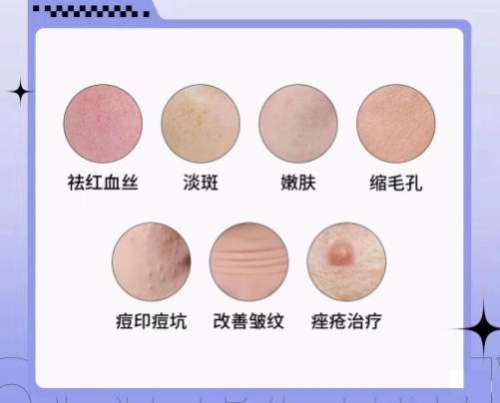 光子嫩肤
