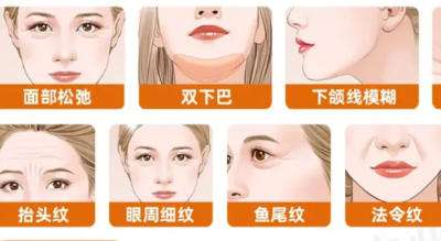 热玛吉