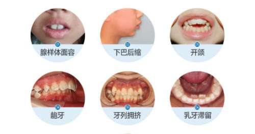 牙齿矫正