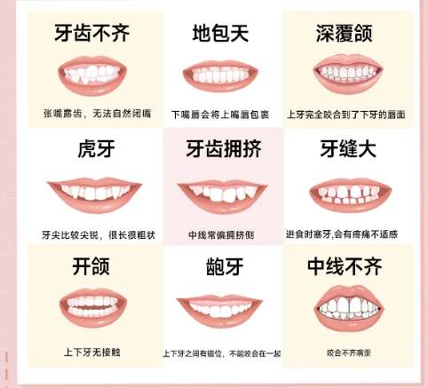 牙齿矫正