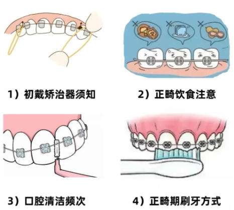 牙齿矫正