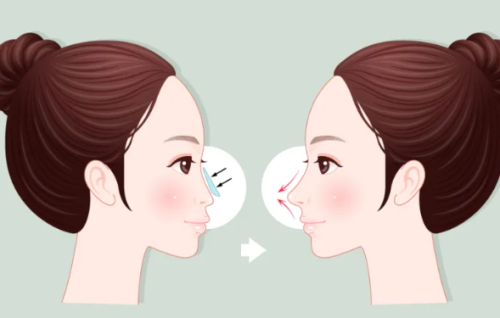 QQ截图20260409165317.png