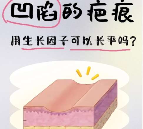 取生长因子