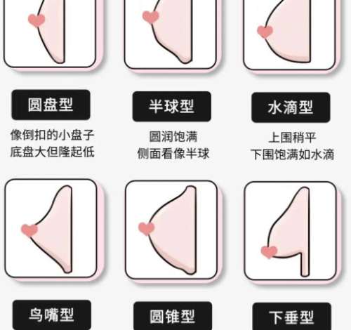 隆胸